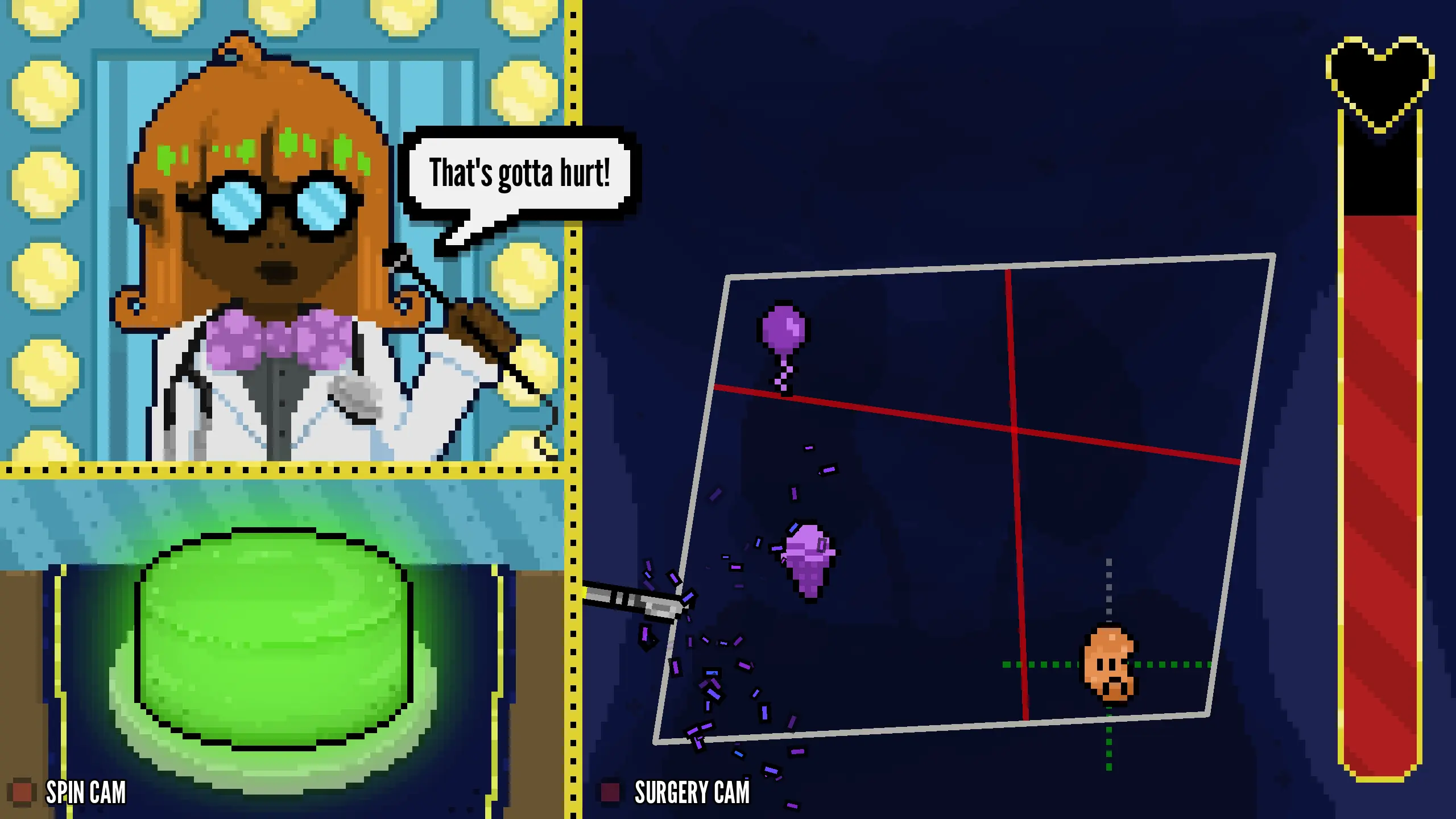 A screenshot from the indie FOSS game Spin-ectomy showing a game screen with 3 sections. In the top left, a commentator comments "That's gotta hurt!", in the bottom left, a green lit up button is waiting with label that says "Spin Cam", and on the right side we see a cartoony surgery where a scalpel is surrounded with confetti after hitting a purple ice cream cone.